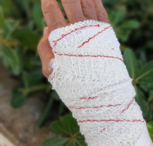 Abogado especialista en delito de lesiones en Madrid
